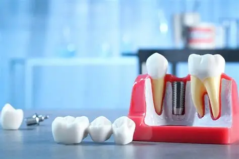 Implants & Crowns