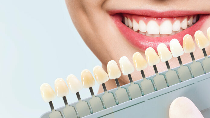 Laser Whitening